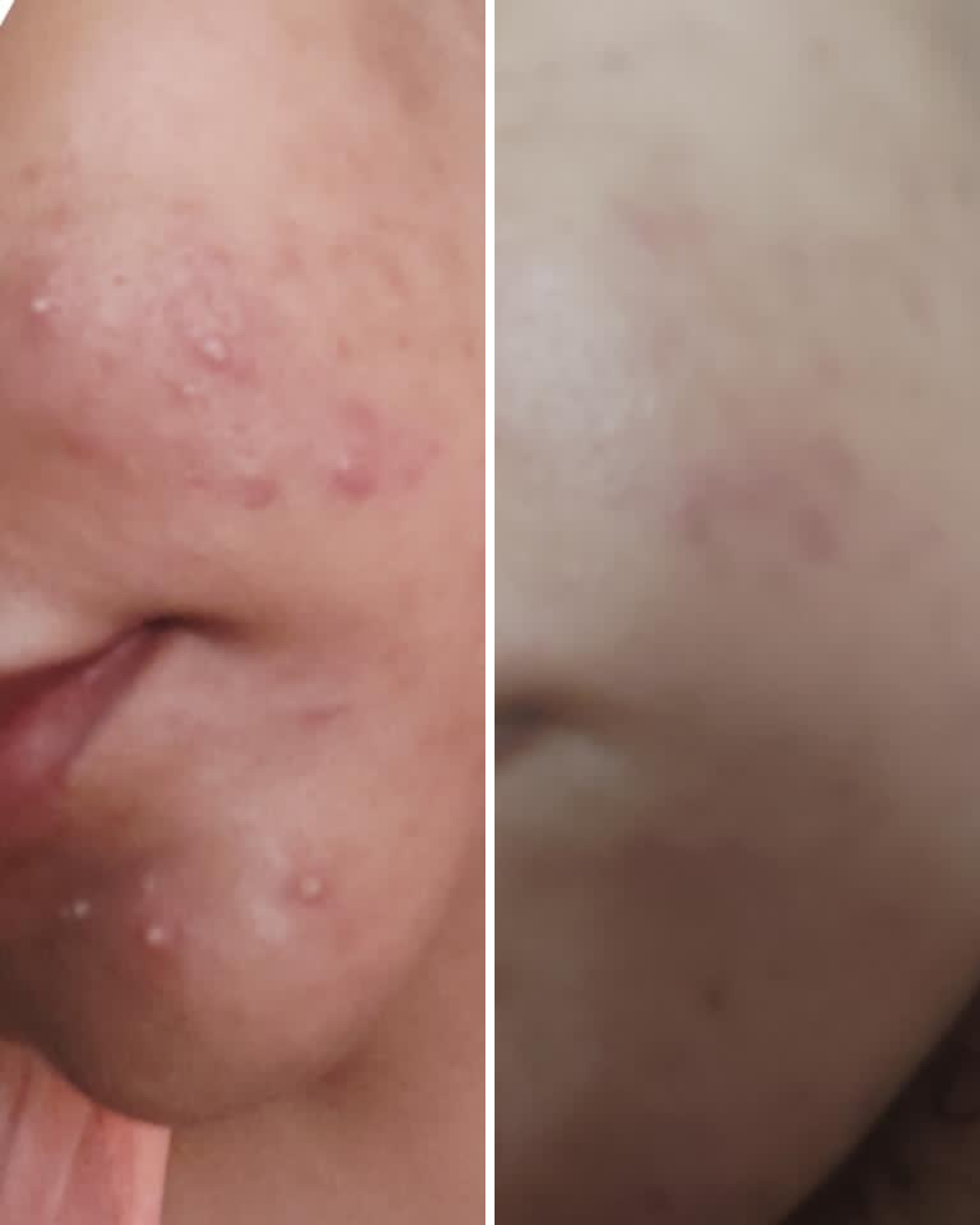 Nirvana Botanics Vitamin C + E Serum – Ml 15