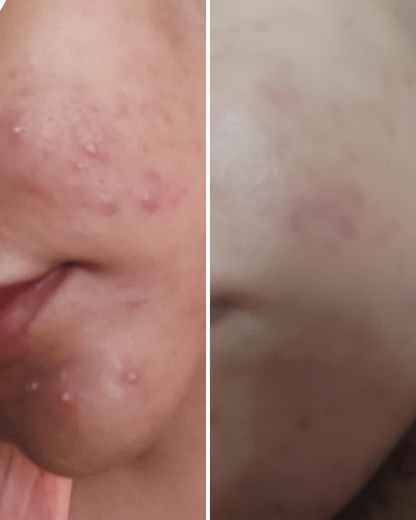 Nirvana Botanics Vitamin C + E Serum – Ml 15